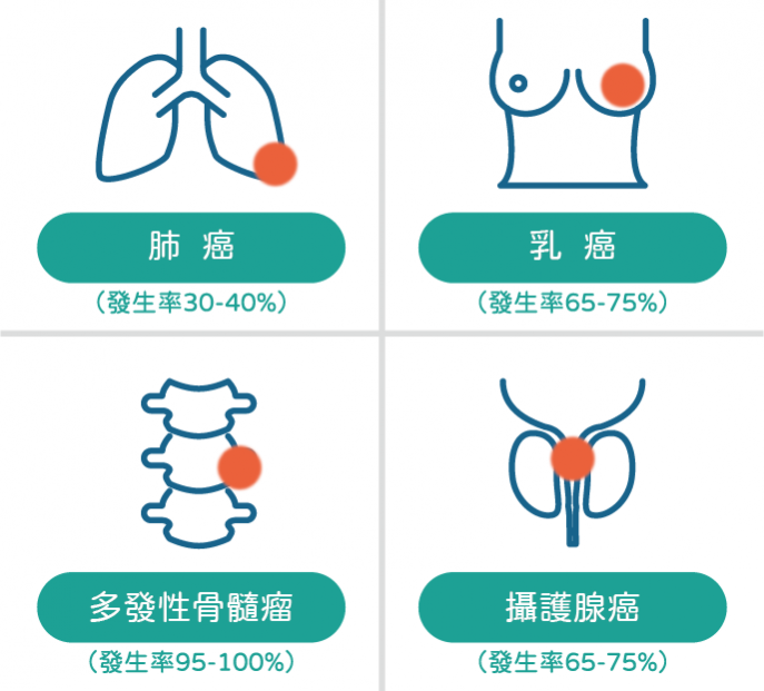 什麼是癌症骨轉移